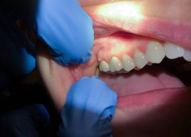 Best Emergency Denture Repair in South Pottstown, PA