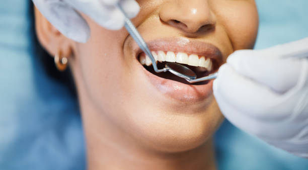 Best Emergency Dental Care for Sports Injuries in South Pottstown, PA